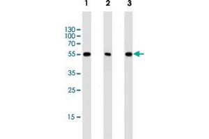 Western blot analysis of Lane 1: Hela cell line lysates Lane 2: Jurkat cell line lysates Lane 3: mouse NIH/3T3 cell line lysates reacted with PPARA monoclonal antibody  at 1:1000 dilution.