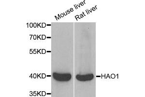 Western blot analysis of extracts of various cell lines, using HAO1 antibody (ABIN5973868) at 1/1000 dilution. (HAO1 antibody)
