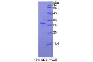 SDS-PAGE (SDS) image for Slow Skeletal Troponin T (TNNT1) (AA 1-228) protein (His tag) (ABIN1821720) (TNNT1 Protein (AA 1-228) (His tag))