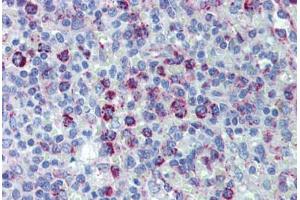 Human Spleen (formalin-fixed, paraffin-embedded) stained with HSPD1 antibody ABIN462365 followed by biotinylated anti-goat IgG secondary antibody ABIN481715, alkaline phosphatase-streptavidin and chromogen. (HSPD1 antibody)