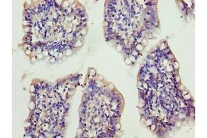 Immunohistochemistry of paraffin-embedded human small intestine tissue using ABIN7175892 at dilution of 1:100 (XRRA1 antibody  (AA 101-400))