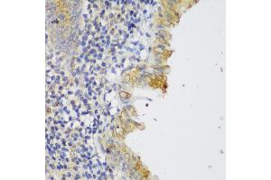 Immunohistochemistry of paraffin-embedded human appendix using GCC2 antibody (ABIN6130422, ABIN6141007, ABIN6141008 and ABIN6217941) at dilution of 1:150 (40x lens). (GCC2 antibody  (AA 1-300))