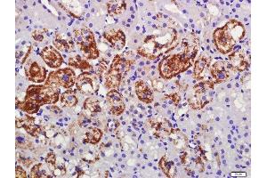 Paraformaldehyde-fixed, paraffin embedded rat kidney tissue, Antigen retrieval by boiling in sodium citrate buffer(pH6) for 15min, Block endogenous peroxidase by 3% hydrogen peroxide for 30 minutes, Blocking buffer (normal goat serum) at 37°C for 20min, Antibody incubation with C1orf173 Polyclonal Antibody, Unconjugated  at 1:500 overnight at 4°C, followed by a conjugated secondary and DAB staining (C1orf173 antibody  (AA 301-400))