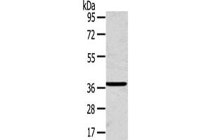 Gel: 8 % SDS-PAGE,Lysate: 40 μg,Primary antibody: ABIN7192440(SLC25A20 Antibody) at dilution 1/200 dilution,Secondary antibody: Goat anti rabbit IgG at 1/8000 dilution,Exposure time: 1 minute (SLC25A2 antibody)