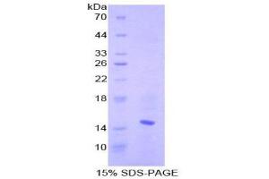 SDS-PAGE (SDS) image for Chemokine (C-C Motif) Ligand 6 (CCL6) (AA 22-116) protein (His tag) (ABIN2125771)