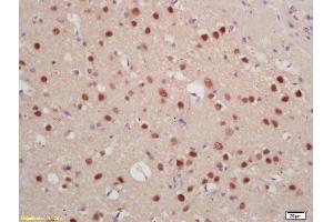 Formalin-fixed and paraffin embedded rat brain labeled with Rabbit Anti Jarid2/Jumonji Polyclonal Antibody, Unconjugated (ABIN1386206) at 1:200 followed by conjugation to the secondary antibody and DAB staining (JARID2 antibody  (AA 301-400))