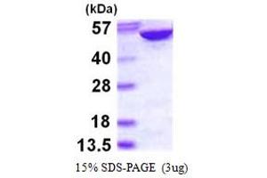 SDS-PAGE (SDS) image for Adenylosuccinate Lyase (ADSL) (AA 1-484) protein (His tag) (ABIN667599)