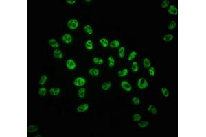 Immunofluorescence staining of Hela cells with ABIN7127726 at 1:100,counter-stained with DAPI. (Recombinant POLR2A/RPB1 antibody  (pSer5))