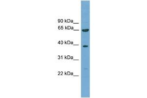 WB Suggested Anti-KLHL20 Antibody Titration: 0. (KLHL20 antibody  (C-Term))