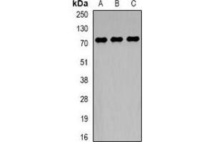 Western blot analysis of TCF4 expression in HepG2 (A), MCF7 (B), mouse brain (C) whole cell lysates. (TCF4 antibody)