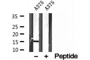 Western blot analysis of extracts of A375 cells, using FABP5 antibody.