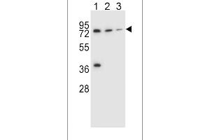 Western blot analysis in NCI-H460(lane 1),HepG2(lane 2),ZR-75-1(lane 3) cell line lysates (35ug/lane). (UGT2B15 antibody  (AA 156-185))