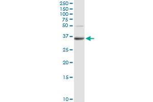 PPAP2A MaxPab rabbit polyclonal antibody. (PPAP2A antibody  (AA 1-284))