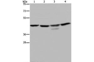 Western Blot analysis of K562 and 293T cell, Jurkat cell and Mouse brain tissue using CSNK2A1 Polyclonal Antibody at dilution of 1:300 (CSNK2A1/CK II alpha antibody)