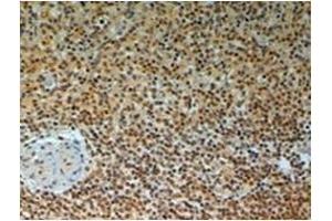 Immunohistochemistry (Paraffin-embedded Sections) (IHC (p)) image for anti-TRAF Interacting Protein (TRAIP) (C-Term) antibody (ABIN783910) (TRAIP antibody  (C-Term))