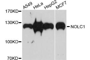 Western blot analysis of extracts of various cell lines, using NOLC1 antibody. (NOLC1 antibody)