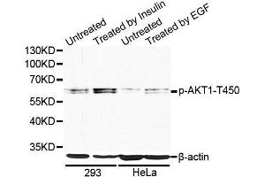 Western blot analysis of extracts of 293 and HeLa cells, using Phospho-AKT1-T450 antibody (ABIN5969867) at 1/1000 dilution. (AKT1 antibody  (pThr450))
