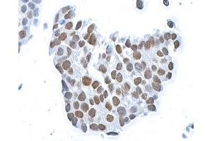 Immunocytochemistry (ICC) image for anti-BMI1 Polycomb Ring Finger Oncogene (BMI1) (AA 250-300) antibody (ABIN7455106) (Recombinant BMI1 antibody  (AA 250-300))