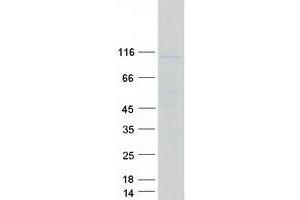 Coiled-Coil Domain Containing 87 (CCDC87) protein (Myc-DYKDDDDK Tag)