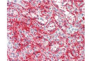 Anti-HLA-A antibody IHC staining of human spleen. (HLA-A antibody  (AA 70-99))