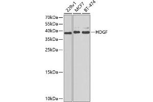 Western blot analysis of extracts of various cell lines, using HDGF antibody  at 1:1000 dilution. (HDGF antibody  (AA 1-240))