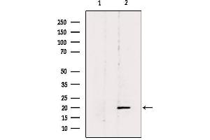 Western blot analysis of extracts from 293, using BTC Antibody. (Betacellulin antibody  (N-Term))