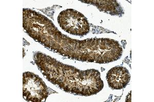 IHC analysis of IFT88 using anti-IFT88 antibody (ABIN7600458). (IFT88 antibody  (AA 198-814))