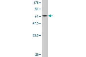 Western Blot detection against Immunogen (75. (TUBA4A antibody  (AA 1-448))