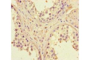 Immunohistochemistry (IHC) image for anti-DNA (Cytosine-5-)-Methyltransferase 3 beta (DNMT3B) (AA 1-100) antibody (ABIN7150116)