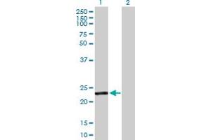 Western Blot analysis of GSTA4 expression in transfected 293T cell line by GSTA4 MaxPab polyclonal antibody. (GSTA4 antibody  (AA 1-222))