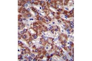 Immunohistochemistry analysis in formalin fixed and paraffin embedded human liver tissue reacted with OR2B11 Antibody (C-term) followed which was peroxidase conjugated to the secondary antibody and followed by DAB staining. (OR2B11 antibody  (C-Term))