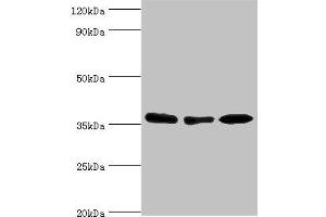 Western blot All lanes: MDH1 antibody at 4 μg/mL Lane 1: HepG2 whole cell lysate Lane 2: Hela whole cell lysate Lane 3: Mouse kidney tissue Secondary Goat polyclonal to rabbit IgG at 1/10000 dilution Predicted band size: 37, 28, 39 kDa Observed band size: 37 kDa (MDH1 antibody  (AA 1-334))