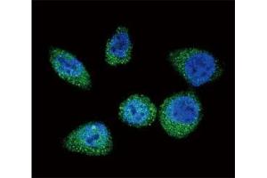 Confocal immunofluorescent analysis of mTOR antibody with HeLa cells followed by Alexa Fluor 488-conjugated goat anti-rabbit lgG (green). (MTOR antibody  (AA 2459-2488))