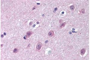 Human Brain, Cortex (formalin-fixed, paraffin-embedded) stained with IPO9 antibody ABIN297232 at 10 ug/ml followed by biotinylated goat anti-rabbit IgG secondary antibody ABIN481713, alkaline phosphatase-streptavidin and chromogen. (Importin 9 antibody  (AA 950-1000))