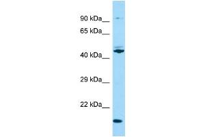 Western Blotting (WB) image for anti-Outer Dense Fiber of Sperm Tails 3 (ODF3) (N-Term) antibody (ABIN2790487)