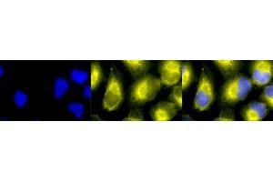 Immunocytochemistry/Immunofluorescence analysis using Rabbit Anti-PDI Polyclonal Antibody (ABIN361828 and ABIN361829). (P4HB antibody  (AA 409-509))