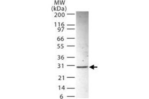 Western blot analysis of ANP32B in HL-60 whole cell lysate using ANP32B polyclonal antibody  at 2 ug/mL . (ANP32B antibody  (AA 1-17))