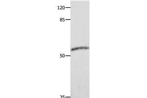 Western Blot analysis of Human fetal muscle tissue using CAP2 Polyclonal Antibody at dilution of 1:600