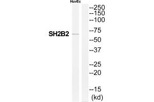 Western Blotting (WB) image for anti-SH2B Adaptor Protein 2 (SH2B2) (Internal Region) antibody (ABIN1852148) (SH2B2 antibody  (Internal Region))