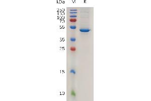 Mouse BAFF Protein, hFc Tag on SDS-PAGE under reducing condition. (BAFF Protein (Fc Tag))