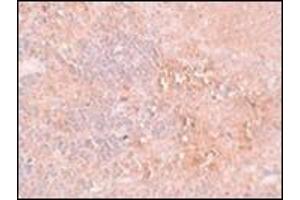 Immunohistochemistry of JMJD4 in rat spleen tissue with this product at 2.