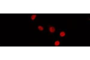 ABIN6272431 staining MCF7 by IF/ICC. (SIN3B antibody  (Internal Region))