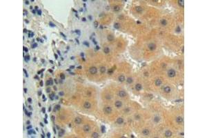 IHC-P analysis of liver tissue, with DAB staining. (MMP15 antibody  (AA 280-497))