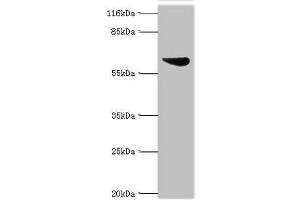 Western blot All lanes: Set1/Ash2 histone methyltransferase complex subunit ASH2 antibody at 2 μg/mL + K562 whole cell lysate Secondary Goat polyclonal to rabbit IgG at 1/10000 dilution Predicted band size: 69, 57, 61 kDa Observed band size: 69 kDa (ASH2L antibody  (AA 1-534))