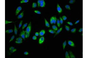Immunofluorescence staining of Hela cells with ABIN7144757 at 1:100, counter-stained with DAPI.