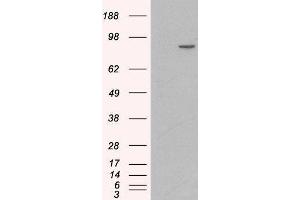 Western Blotting (WB) image for Catenin (Cadherin-Associated Protein), alpha 1, 102kDa (CTNNA1) peptide (ABIN369355) (Catenin (Cadherin-Associated Protein), alpha 1, 102kDa (CTNNA1) Peptide)