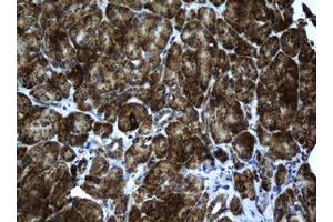 ACADS antibody  (AA 34-260)
