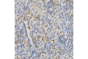 Immunohistochemistry of paraffin-embedded rat spleen using IL11RA Rabbit mAb (ABIN7267984) at dilution of 1:150 (40x lens). (IL11RA antibody)