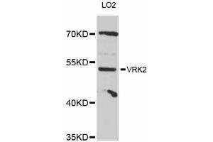 Western blot analysis of extracts of LO2 cells, using VRK2 antibody (ABIN5999182) at 1:3000 dilution. (VRK2 antibody)