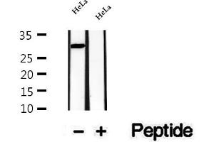 Western blot analysis of extracts of HeLa cells, using CPSF4 antibody. (CPSF4 antibody  (C-Term))